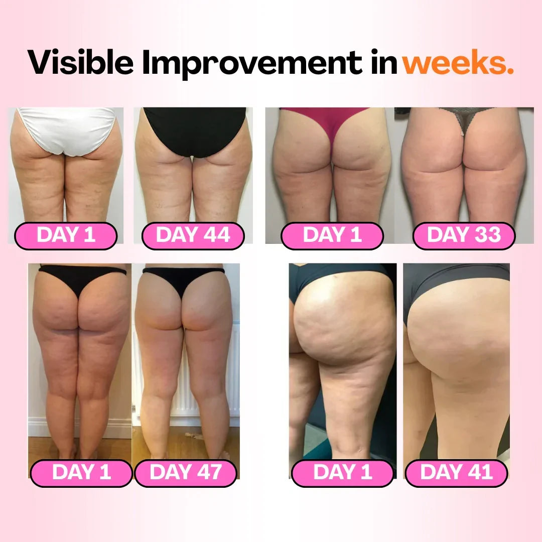 Anti-Cellulite Strumpfhosen - Definieren Sie Ihre Silhouette mühelos (3er-Pack)