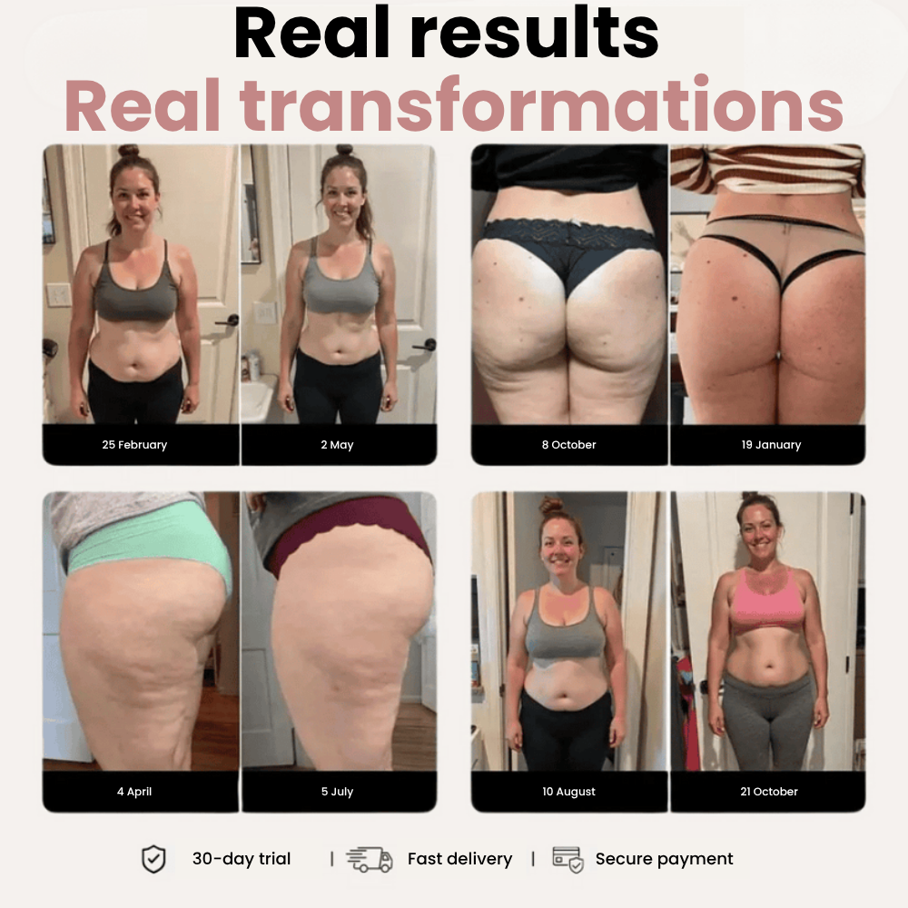 Movvi 3D Kompressionsleggings – Lipoedem Linderung